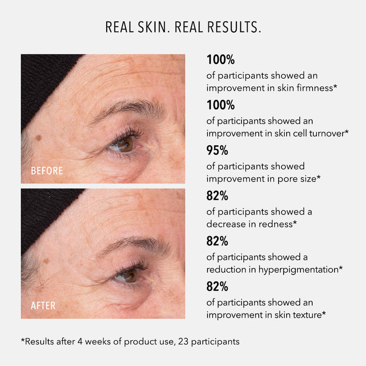Liquid Resurfacing Solution Daily Leave-In Exfoliant