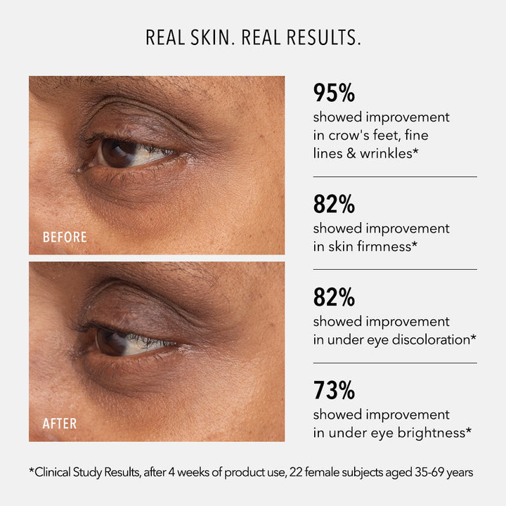 Retinol Eye Renewal Lifting & Firming Balm 15ml