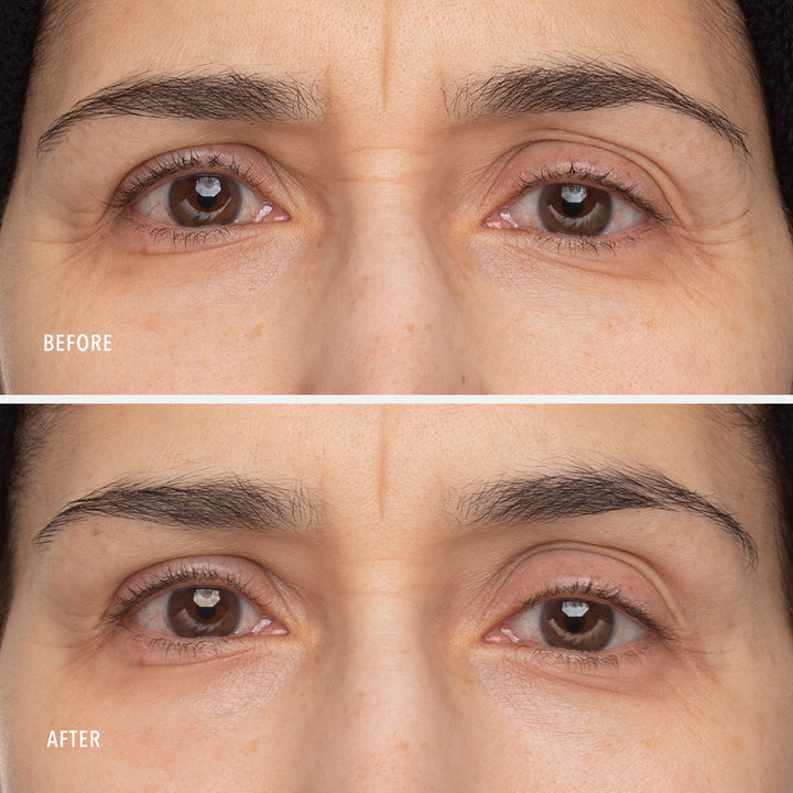 Retinol Eye Renewal Lifting & Firming Balm 15ml