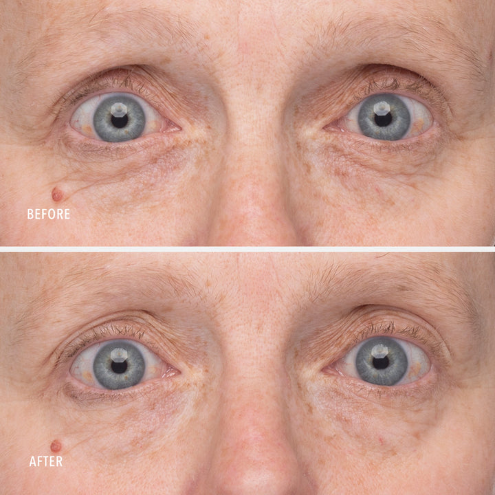 Retinol Eye Renewal Lifting & Firming Balm 15ml