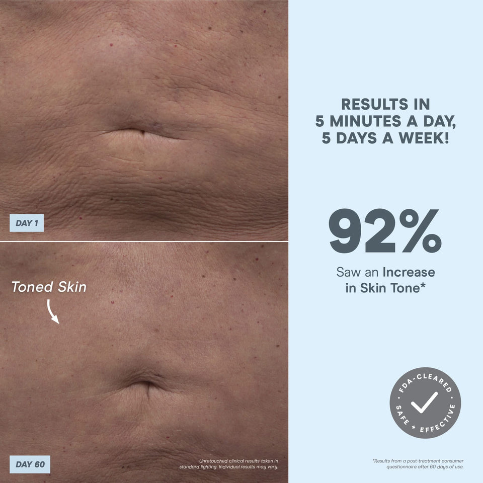 Microcurrent Skin Toning Device for Body