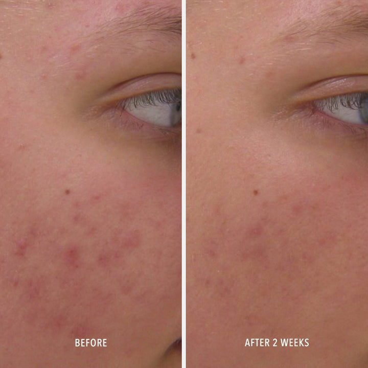 Clear Rescue Skin-Refining Serum