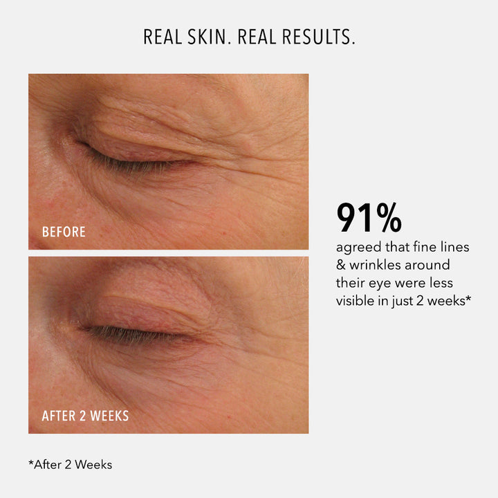 Eye Authority: Dark Circles, Puffiness, Fine Lines 15ml