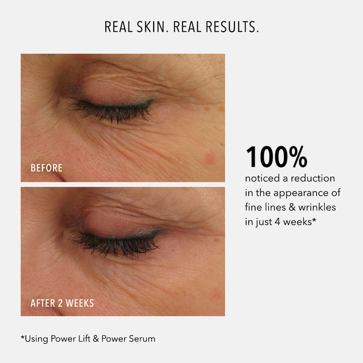 Power Lift: Advanced Ultra-Lift Moisturizer 30ml