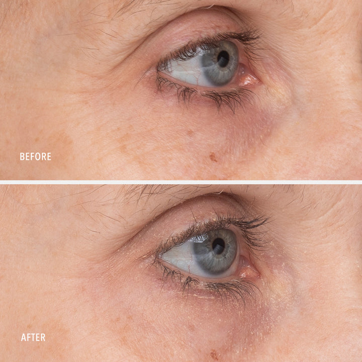 Retinol Eye Renewal Lifting & Firming Balm 15ml