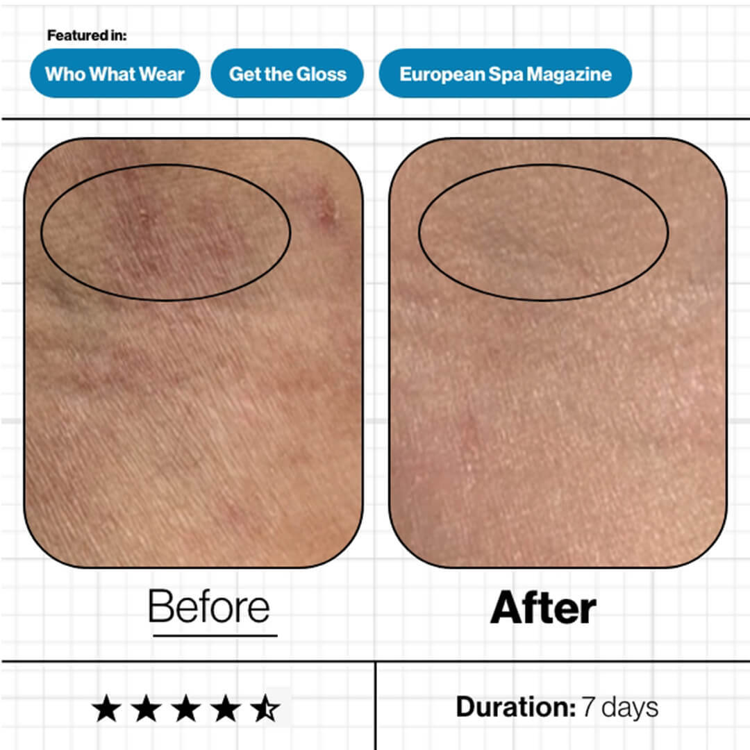 Skin Moisture IQ 28 Pods Smart Supplement System
