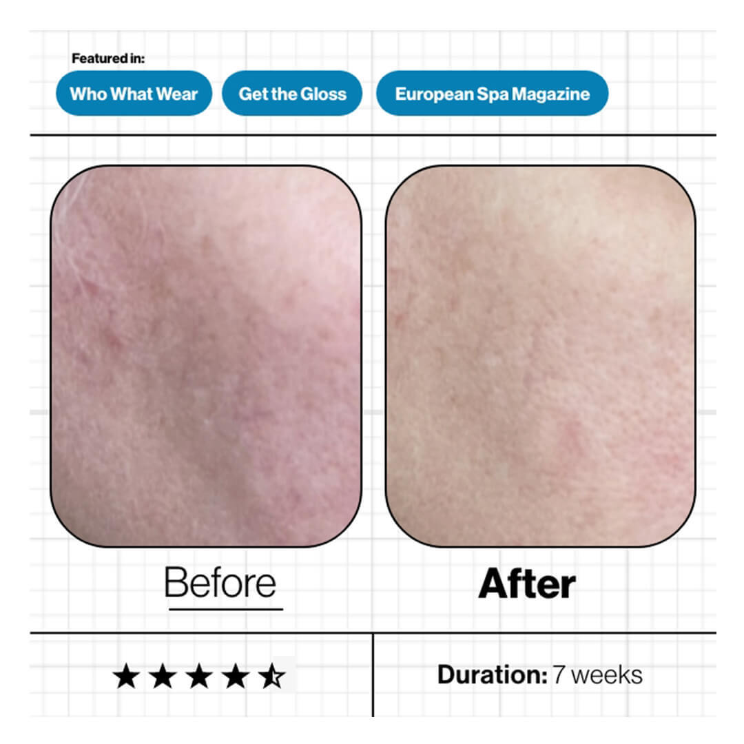 Skin Moisture IQ 28 Pods Smart Supplement System