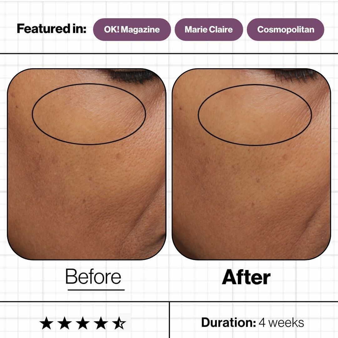 Skin Ultimate 28 Pods of Beauty