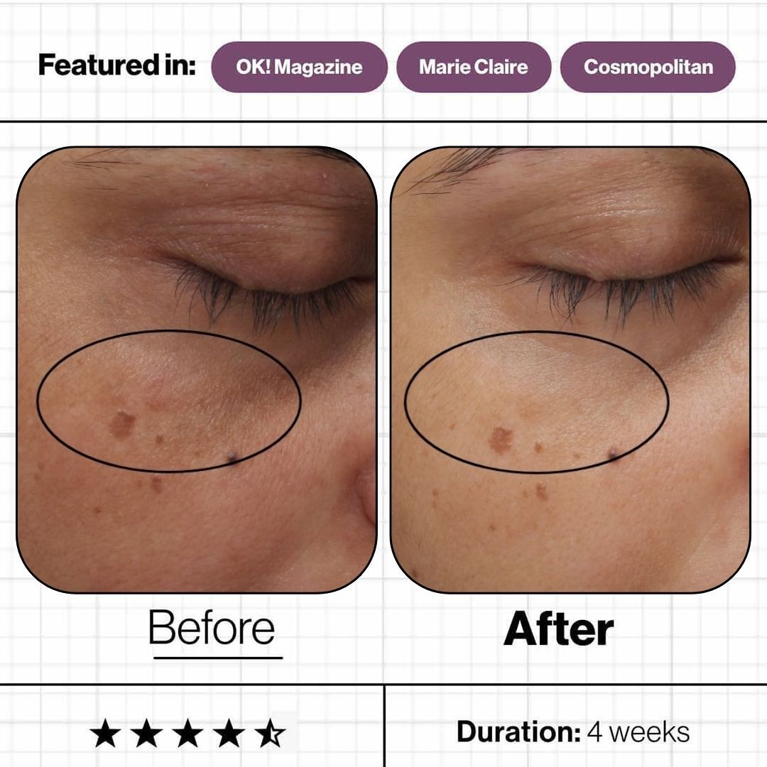 Skin Ultimate 28 Pods of Beauty