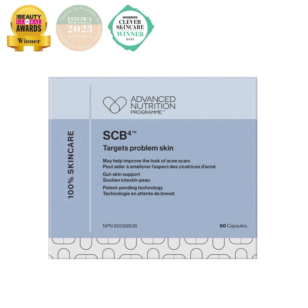 SCB4