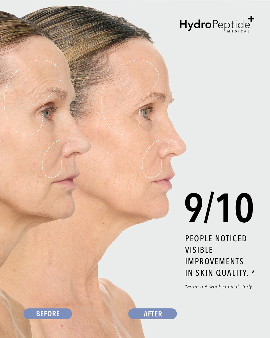 Reactive Rx Serum